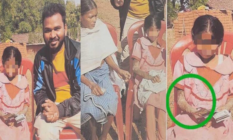 पत्थर शरीर वाली बच्ची के उपचार को लेकर बाल आयोग सक्रिय पत्थर-शरीर-वाली-बच्ची-के-उपचार-को-लेकर-बाल-आयोग-सक्रिय
