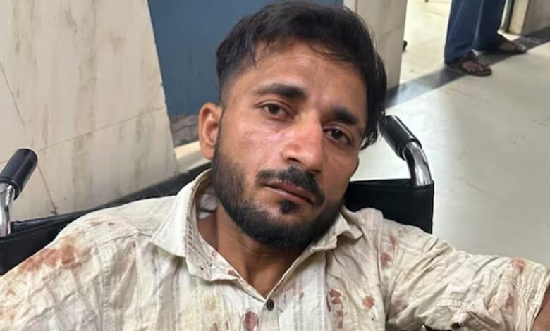 UP पुलिस परीक्षा देने जा रही छात्राओं से छेड़छाड़, आरोपी ऑटो ड्राइवर पुलिस एनकाउंटर में घायल up-पुलिस-परीक्षा-देने-जा-रही-छात्राओं-से-छेड़छाड़,-आरोपी-ऑटो-ड्राइवर-पुलिस-एनकाउंटर-में-घायल