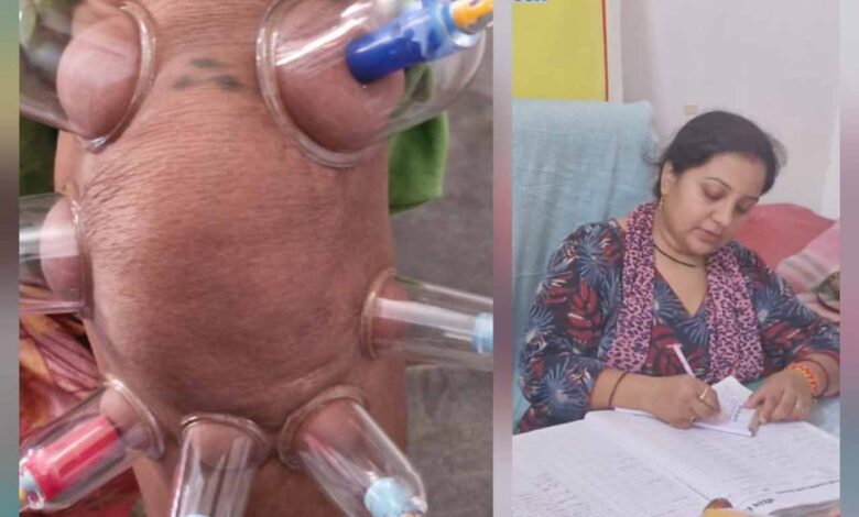 लोहरसी आयुर्वेदिक औषधालय में दर्द प्रबंधन हेतु कपिंग थेरेपी एवं विशेष आयुर्वेदिक उपचार सेवाओं का आरंभ लोहरसी-आयुर्वेदिक-औषधालय-में-दर्द-प्रबंधन-हेतु-कपिंग-थेरेपी-एवं-विशेष-आयुर्वेदिक-उपचार-सेवाओं-का-आरंभ